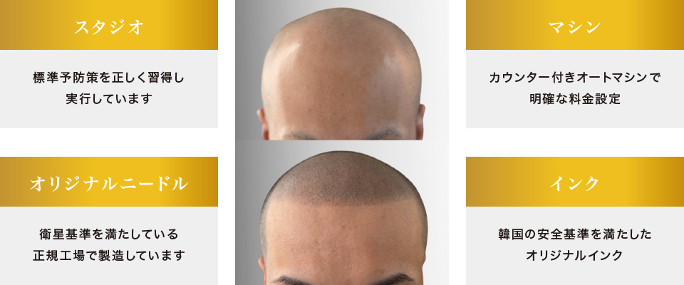 ����